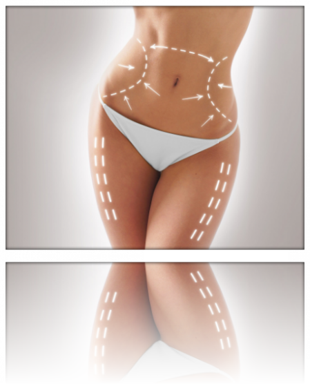 Lipoice Onda Ultrasonica